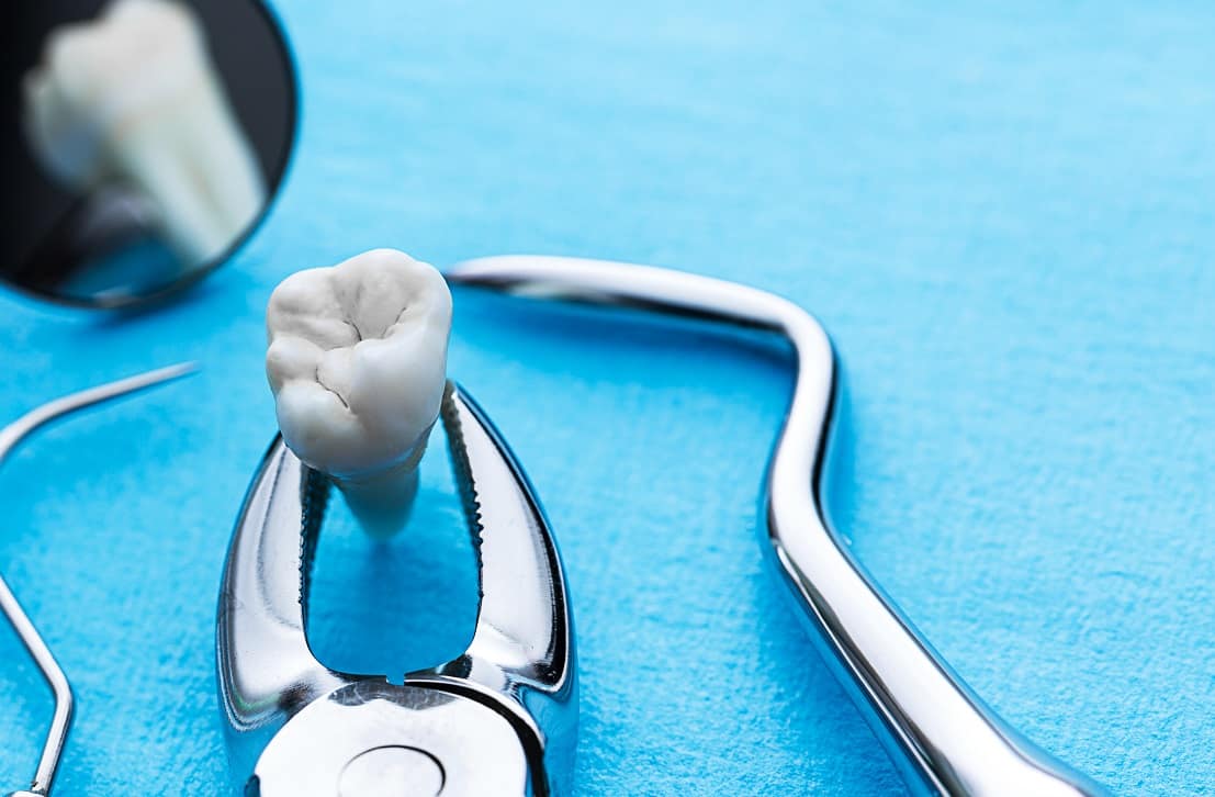 signs of losing a tooth
